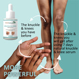 7Days Natural Whitening Serum For Removing Dark Knuckles Elbow and Knee (30 ml)