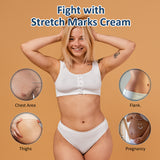 Stretch Mark Removal Cream During Pregnancy | 7Days Natural