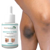 7Days Natural Whitening Serum For Removing Dark Knuckles Elbow and Knee (30 ml)