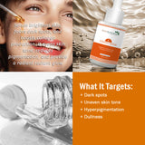 7Days Natural Vitamin-C Serum With Hyaluronic Acid, Face Pigmentation And Oily Skin, Fairness Brightening (30 ml)