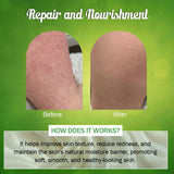 7Days Natural Itch Kure Cream With Ciclopirox Olamine + Tea Tree Oil - 30g