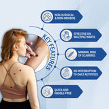 7DAYSNATURAL Wart Removal Cream For Face Wart Removal | Genital wart removal cream | Wart Removal Ointment For Skin | Best Skin Tag Removal Cream (Pack Of 2) (100 gm)