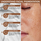 7Days Natural Pigmentation Cream for Acne Scar Removal Pigmentation, Dark Spots & face Glowing (100 g)