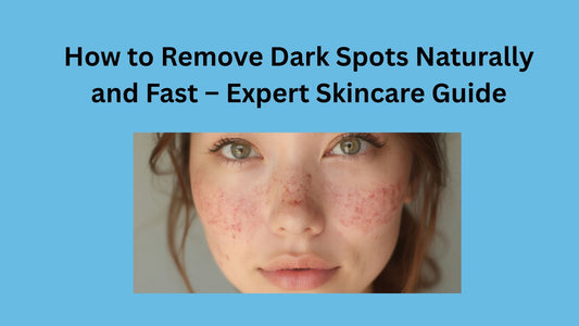 How to Remove Dark Spots Naturally and Fast – Expert Skincare Guide