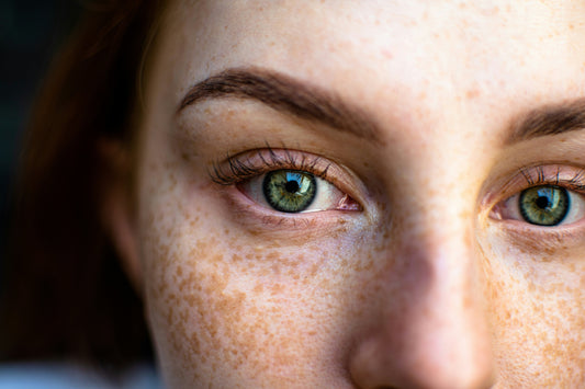 What is Pigmentation? Best Pigmentation Cream for Clear, Glowing Skins