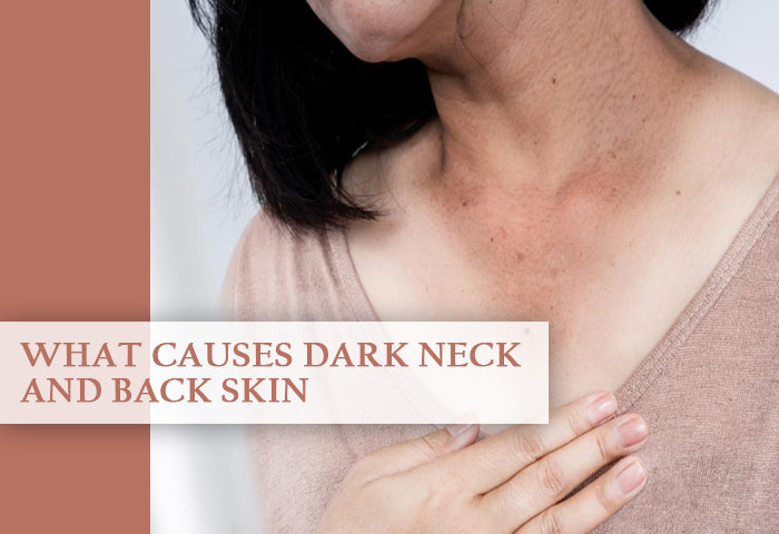 Best Neck & Back Whitening Cream for Dark Spots, Tan & Uneven Skin Tone – 7DaysNatural - 7DaysNatural