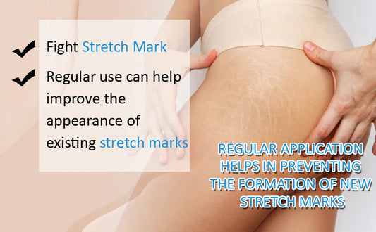 Stretch marks Cream 
