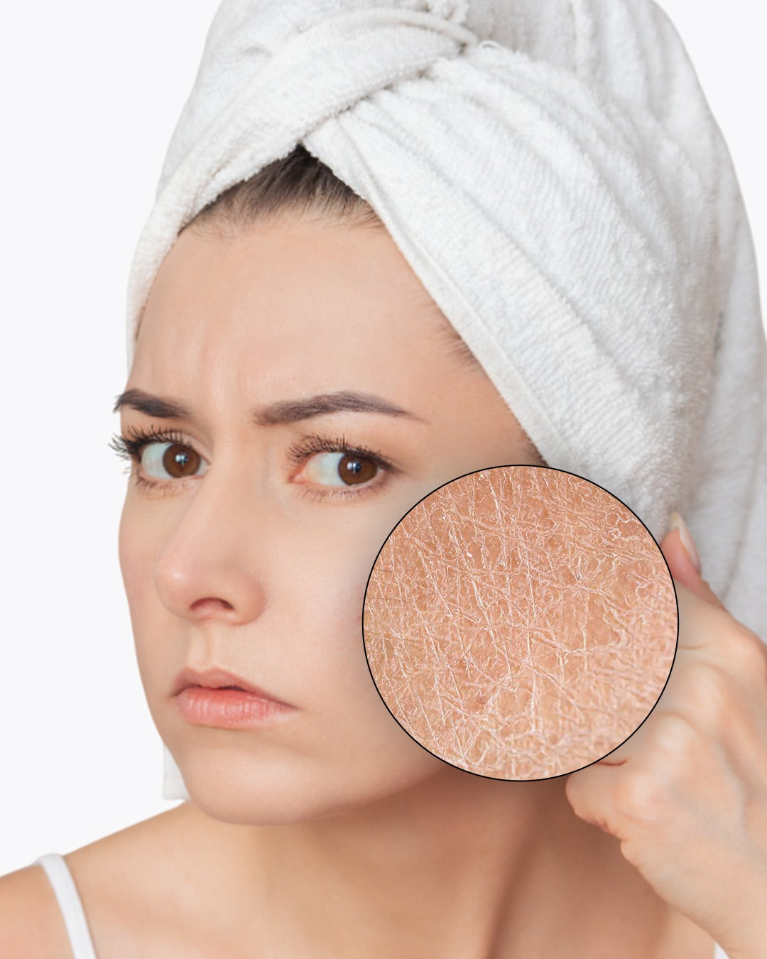 Dry Skin