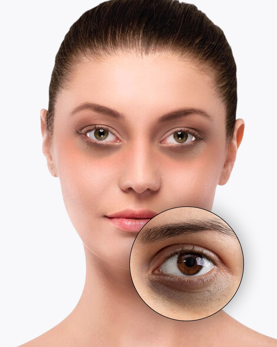Dark Circles