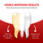 Teeth Whitening Powder |Enamel Safe Teeth| 35g ₹299| 7DaysNatural - 7DaysNatural