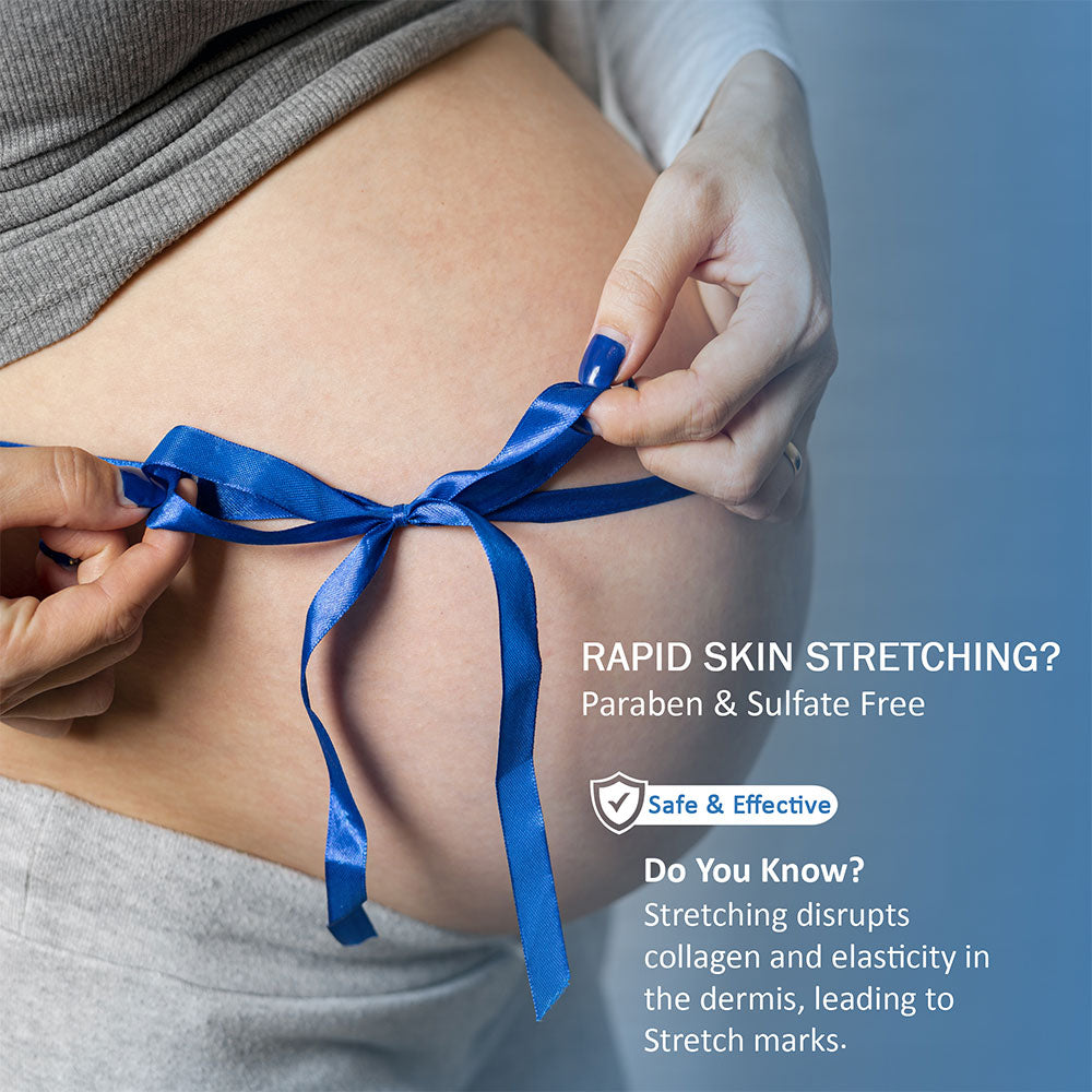 Pregnancy Stretch Mark Cream | Stretch Mark Removal Cream | 7DaysNatural