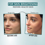 2% Salicylic Acid Serum for Acne Before and after