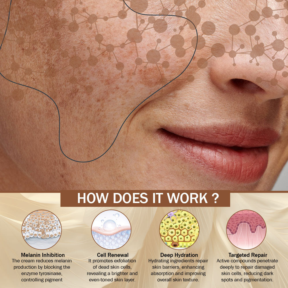 Pigmentation Cream for Acne Scars & Dark Spots | 7DaysNatural