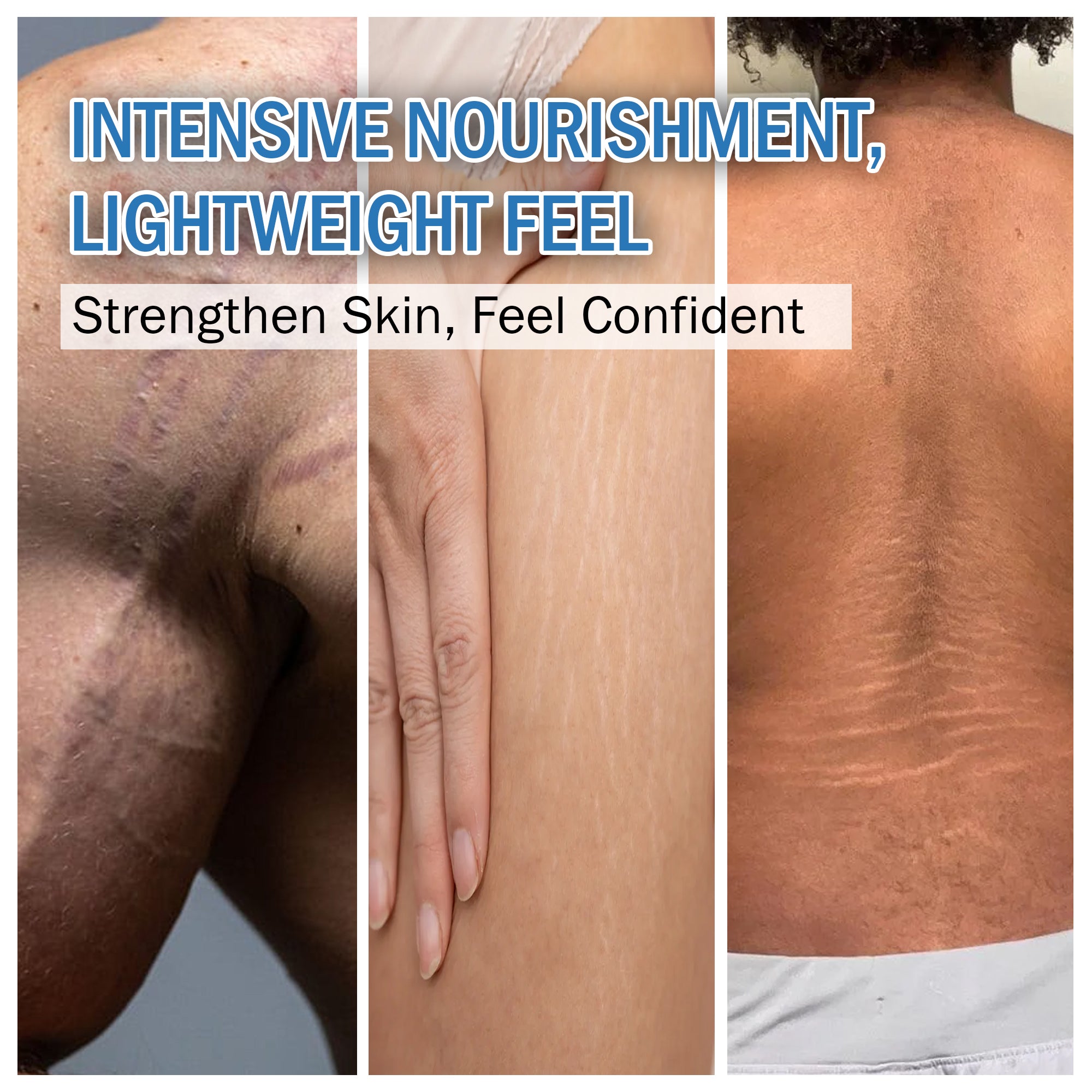 Stretch Marks Scar removal oil | Skincare Oil suitable for Stretch Marks | Scar Removal | Uneven Skin Tone |  7days Natural