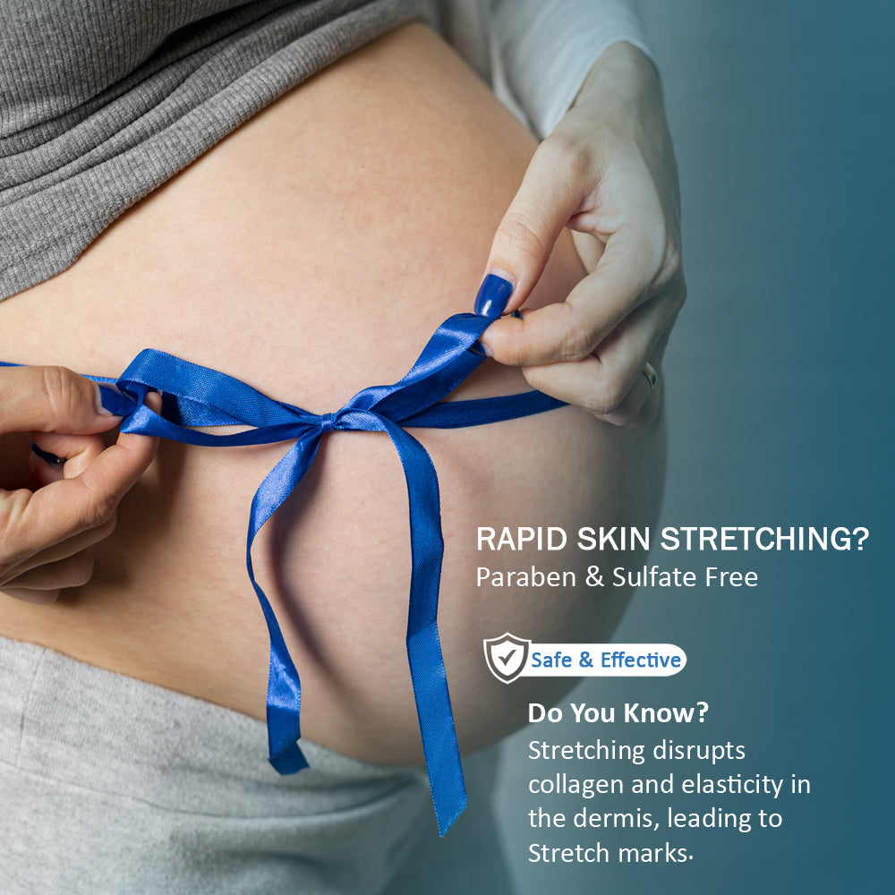 7 Days Natural Stretch Mark Cream – 100g Nourish Your Beauty, Naturally