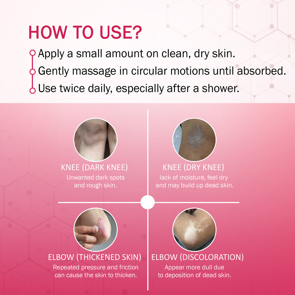 7Days Natural Knee and elbow lightening cream for dark black mark spot blackness dark circles removal cream