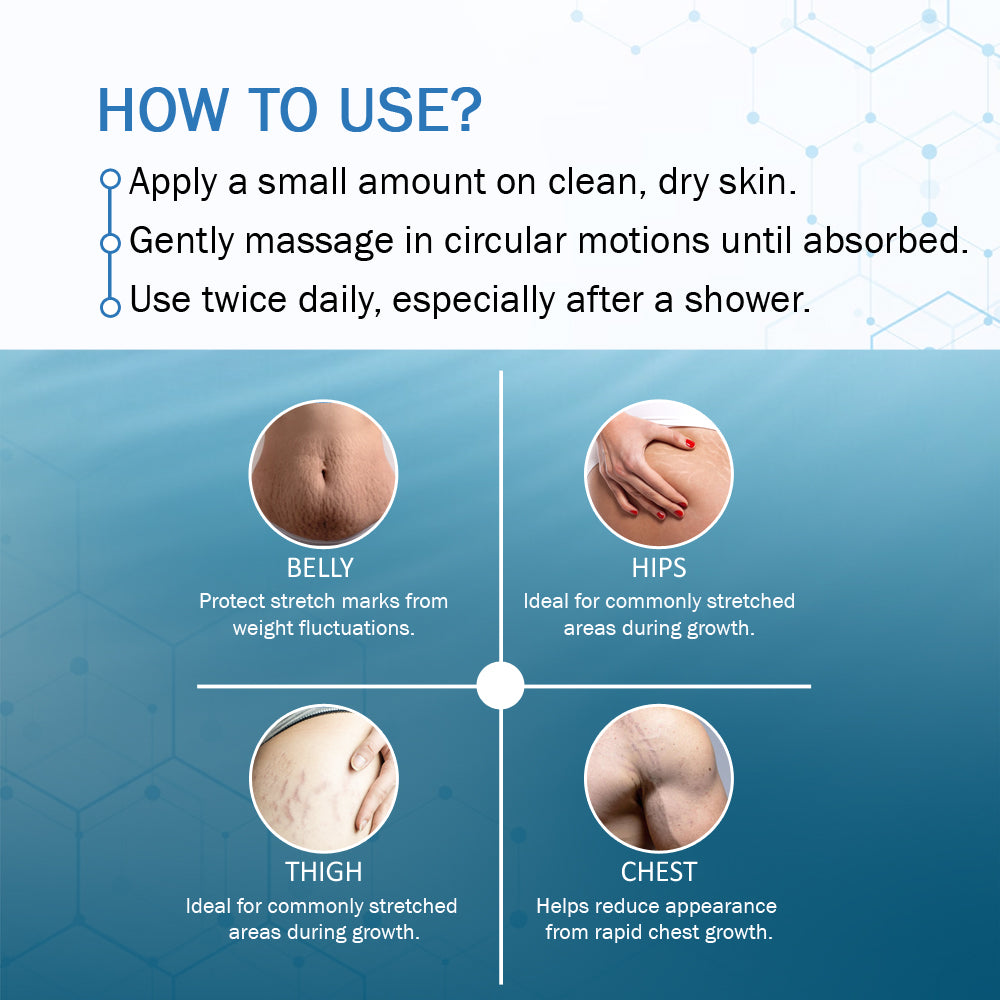 7 Days Natural Stretch Mark Cream – 100g Nourish Your Beauty, Naturally