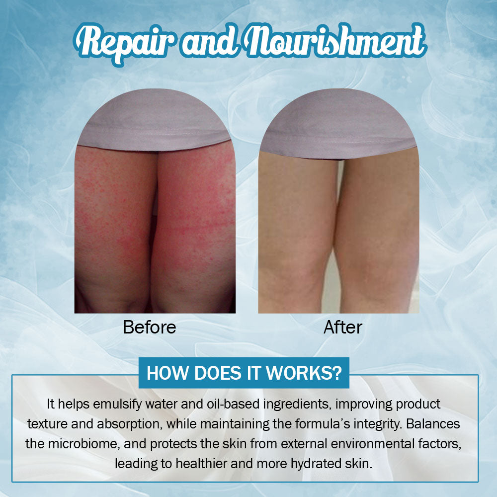 7 DAYS NATURAL Bye-Bye Chafing Cream For Skin - 50GM