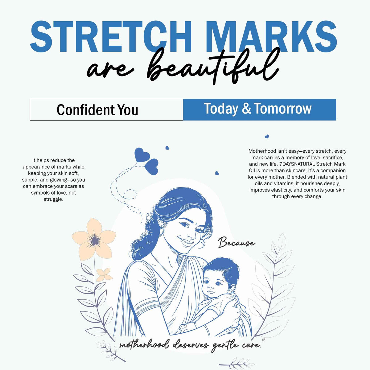 7DaysNatural Stretch Mark Oil for Dry Skin