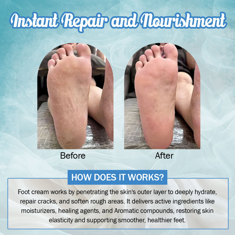 7Days Natural Cracked Heel Repair Foot Cream soothes & softness dry skin  (100 g)