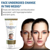 7 Days pigmentation Cream for Acne Scar Removal Pigmentation, Dark Spots & face Glowing (100 g)