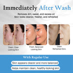 Acne-Prone Skin Soap with Tea Tree Oil
