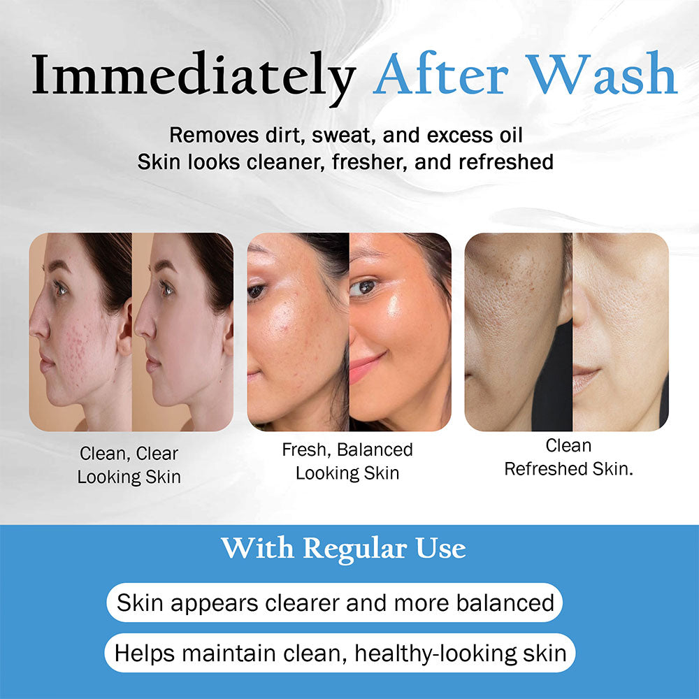 Acne-Prone Skin Soap with Tea Tree Oil