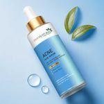 Acne Face Serum