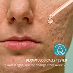 Best Retinol Face Serum for Anti-Aging and Skin Renewal