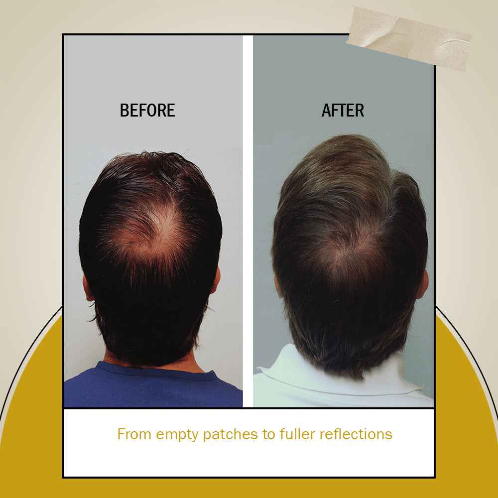 Cantharidine Hair Oil for smooth-looking hair