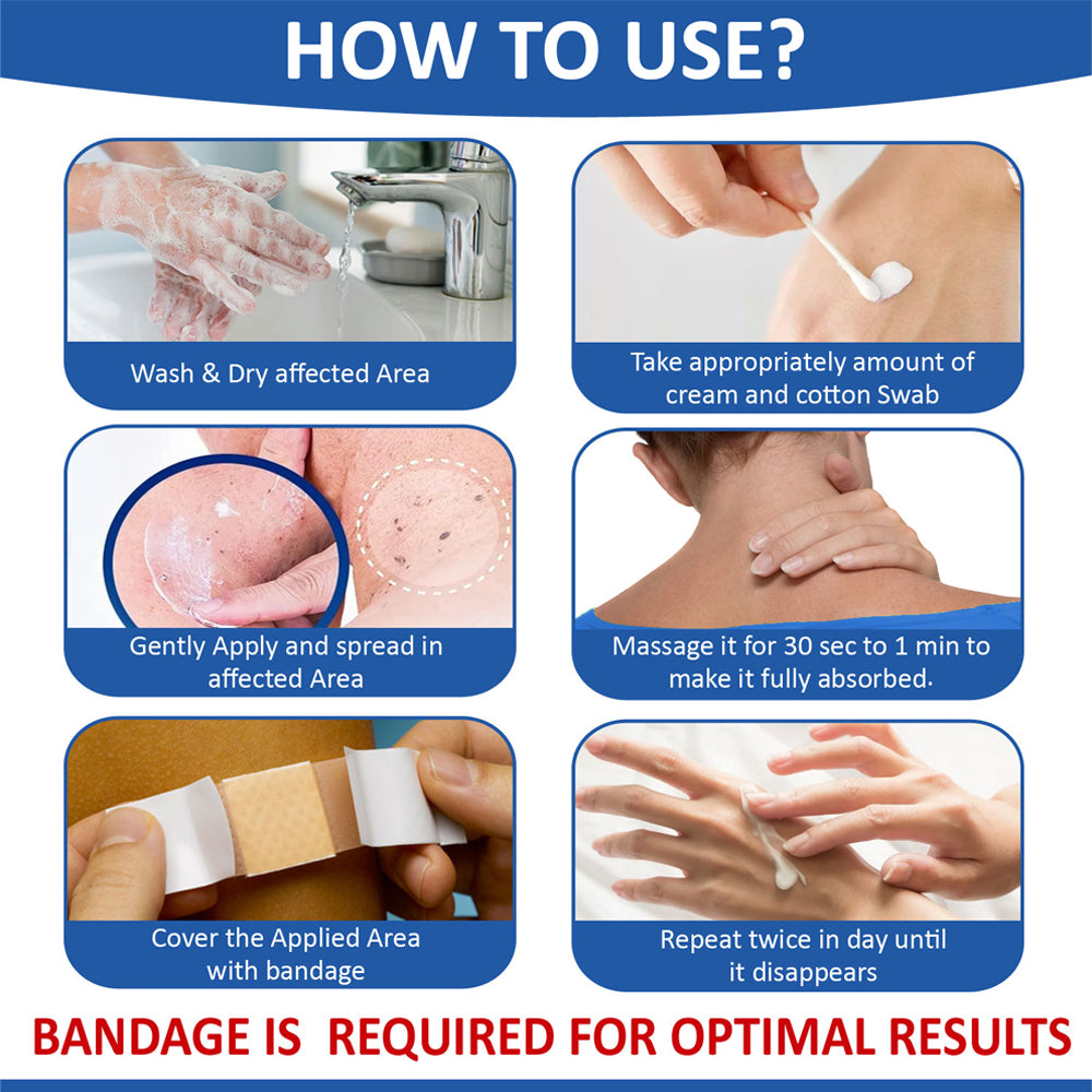 Cream for removing warts and corns