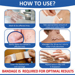 Cream for removing warts and corns