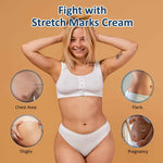 Pregnancy Stretch Mark Removal 