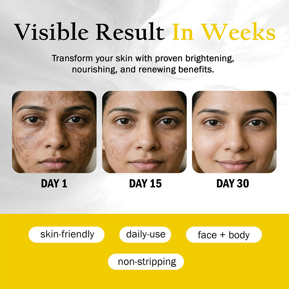 Soap for Dark Spots and Dull Skin