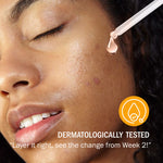 Vitamin C 10% Face Serum for Glowing Skin | 7DaysNatural - 7DaysNatural